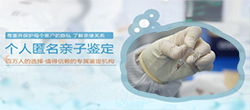 福建头发能办理亲子鉴定吗，隐私亲子鉴定怎么收费